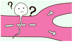 精囊炎要定期排精怎么回事?