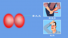 怎么自检是否患上龟头炎呢?