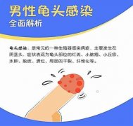男性睾丸炎如何治疗?